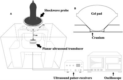 A Single High-Intensity Shock Wave Pulse With Microbubbles Opens the Blood-Brain Barrier in Rats